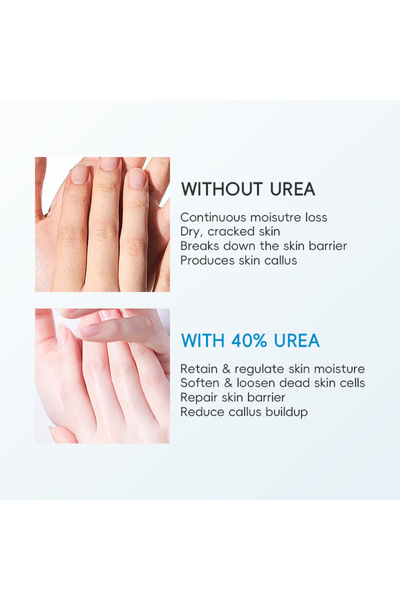 UREA Crema intens hidratanta si reparatoare JOYVIN, cu 40% Uree și 2% Acid Salicilic 150g