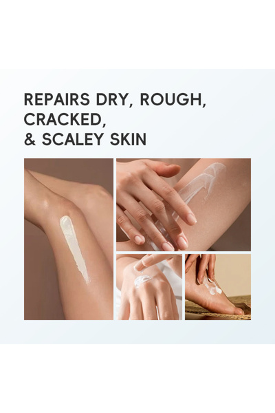 UREA Crema intens hidratanta si reparatoare JOYVIN, cu 40% Uree și 2% Acid Salicilic 150g