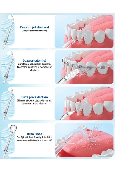 Perfect Medical Set 4 duze pentru duș bucal PM-51 – Standard, Ortodontică, Placă dentară și Limbă – Negru