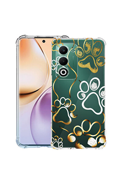 bestcase Αντικραδασμική Θήκη για Xiaomi Redmi 15 (171 χιλ.), Αποτυπώματα πατο...