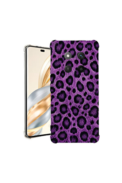 bestcase Αντικραδασμική Θήκη για Honor Magic7 Lite, Σχέδιο Λεοπάρδαλης, 19263...