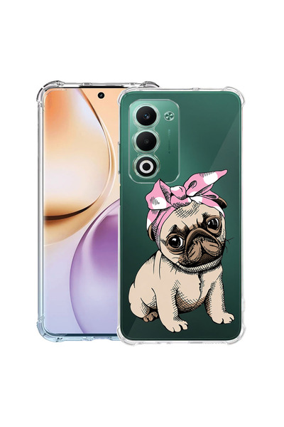 bestcase Αντικραδασμική Θήκη για OPPO A5, Γαλλικό Μπουλντόγκ, 2052056 AS 2206