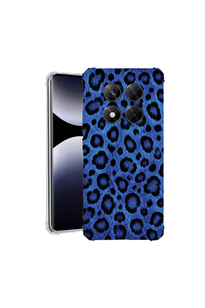 bestcase Αντικραδασμική Θήκη για Xiaomi Redmi Note 15 Pro 5G, Μπλε Σχέδιο Λεο...