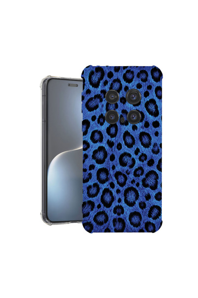 bestcase Αντικραδασμική Θήκη για Honor Magic7 Pro, Μπλε Σχέδιο Λεοπάρδαλης, 1...