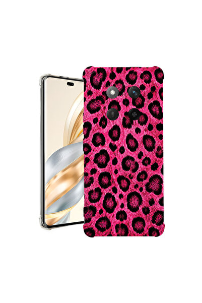 bestcase Αντικραδασμική Θήκη για Honor Magic7 Lite, Ροζ Σχέδιο Λεοπάρδαλης, 1...