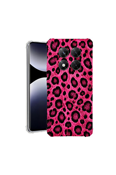 bestcase Αντικραδασμική Θήκη για Xiaomi Redmi Note 15 Pro 5G, Ροζ Σχέδιο Λεοπ...
