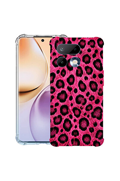 bestcase Противоударен калъф за Realme 16 Pro 5G, розов леопардов десен, 3143...
