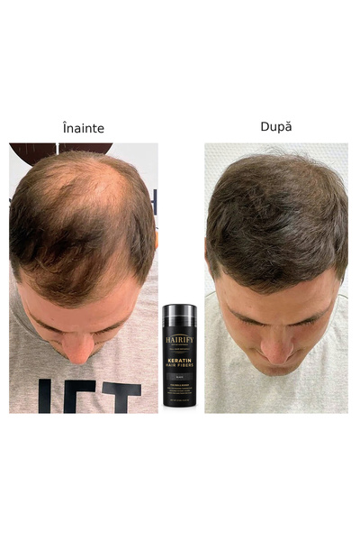 Hairify fibre de păr pentru păr rar, negru, din keratină rezistente la vânt și ploaie, 27.5g