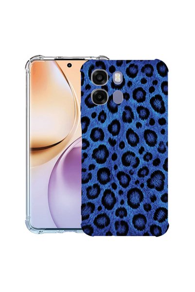 bestcase Αντικραδασμική Θήκη για Realme 16 Pro Plus, Μπλε Σχέδιο Λεοπάρδαλης,...