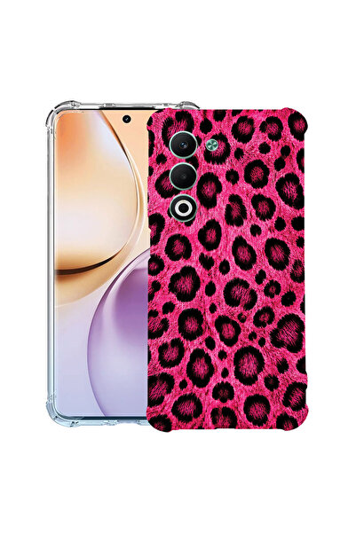 bestcase Αντικραδασμική Θήκη για OPPO A5, Ροζ Σχέδιο Λεοπάρδαλης, 2052056 AS ...