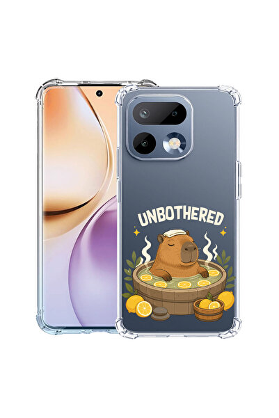 bestcase Αντικραδασμική Θήκη για Realme 16 Pro 5G, Καπιμπάρα Αδιάβροχη, 31439...
