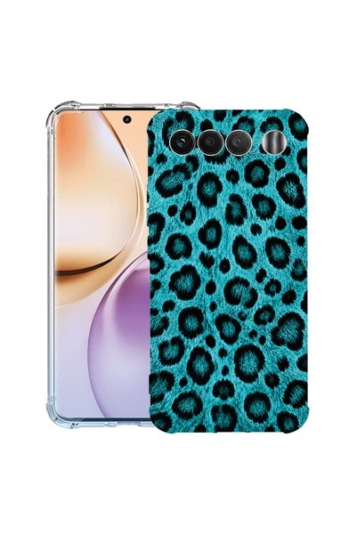 bestcase Αντικραδασμική Θήκη για Realme 16, Τιρκουάζ Σχέδιο Λεοπάρδαλης, 3156...