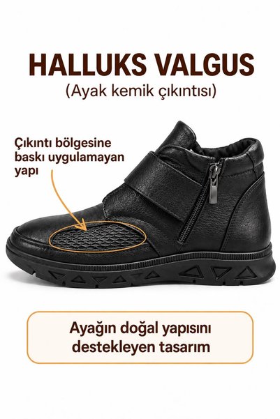 SOLERIUM SHOES حذاء ANNE BOT من الجلد الطبيعي بنعل تشريحي (HALLUX VALGUS) مدع...