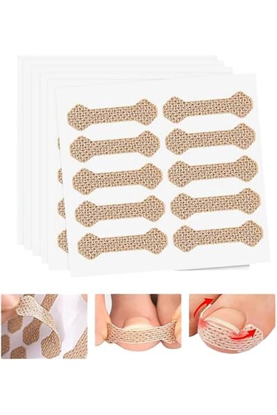 Yelajoy Ingrown Toenail Treatment: 120Pcs Breathable Ingrown Toenail Correcto...