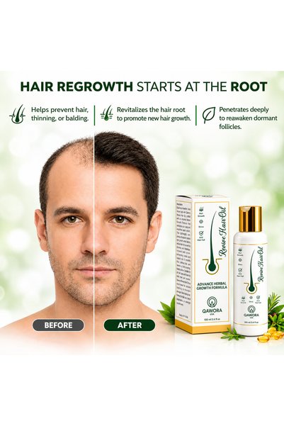 QAWORA Revive Hair Oil 100ml - USA Formula | Supports Hair Growth & Helps Reduce Hair Fall & Helps Control Dandruff | Herbal Hair Oil for Healthier, Shiny & Fuller-Looking Hair