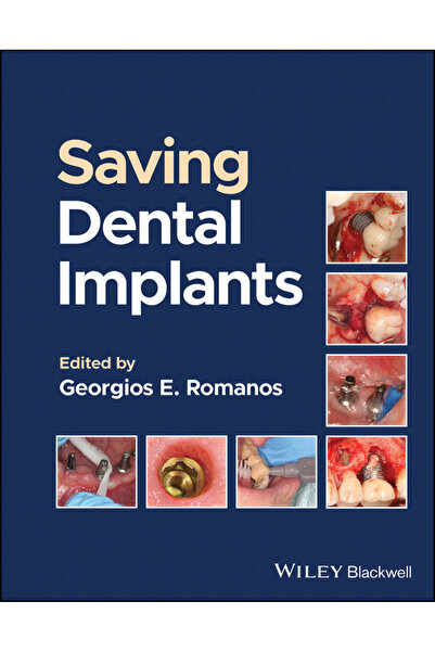 Wiley-Blackwell Reutilizarea implanturilor dentare