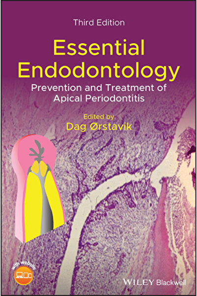 Wiley-Blackwell Endodonție Esențială: Prevenția și Tratamentul Periodontitei ...