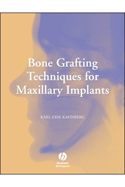 Wiley-Blackwell Bone Grafting Techniques for Maxillary Implants