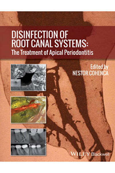 Wiley-Blackwell Dezinfectarea sistemelor de canal radicular: Tratamentul peri...