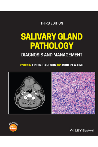 Wiley-Blackwell Patologie a glandelor salivare: Diagnostic și management