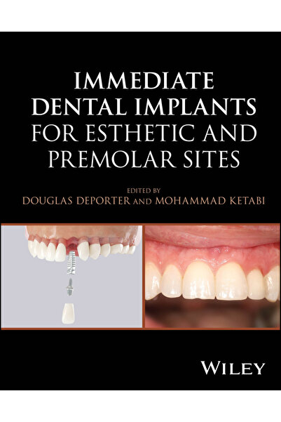 Wiley-Blackwell Implanturi dentare imediate pentru site estetice și premolari