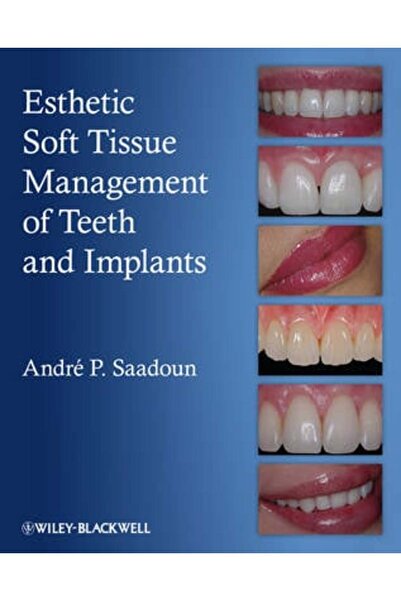 Wiley-Blackwell Esthetic Soft Tissue Management of Teeth and Implants