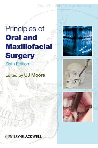 Wiley-Blackwell Principii de Chirurgie Orală și Maxilo-Facială