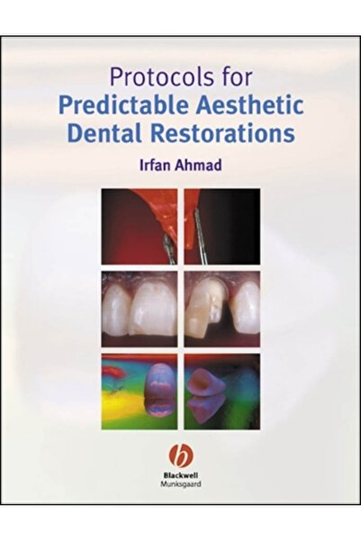 Wiley-Blackwell Protocoluri pentru restaurări dentare estetice predicabile