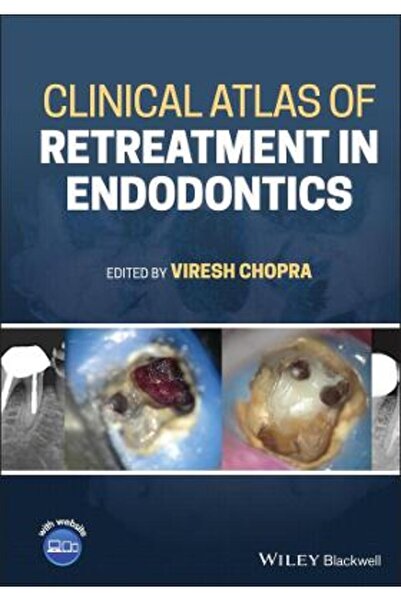 Wiley-Blackwell Atlas clinic de retratament în endodonție