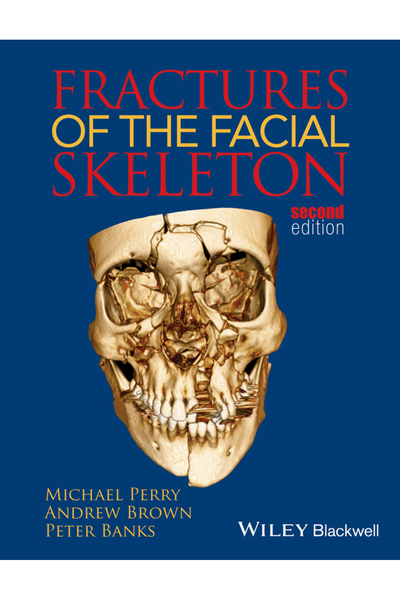 Wiley-Blackwell Fracturi ale scheletului facial
