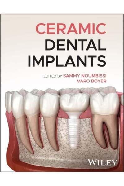 Wiley-Blackwell Ceramic Dental Implants