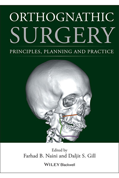 Wiley-Blackwell Chirurgie ortognatică: Principii, Planificare și Practică