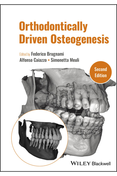 Wiley-Blackwell Osteogeneză condusă ortodontic