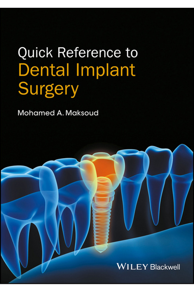 Wiley-Blackwell Quick Reference to Dental Implant Surgery