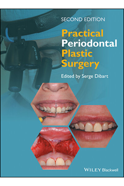 Wiley-Blackwell Practical Periodontal Plastic Surgery