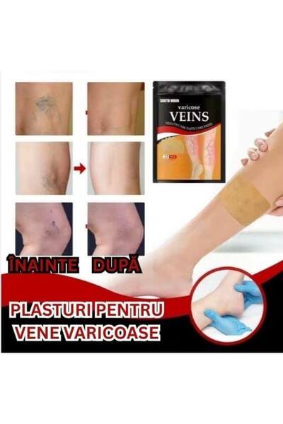 OEM Plasturi Super pentru dispariția venelor varicoase