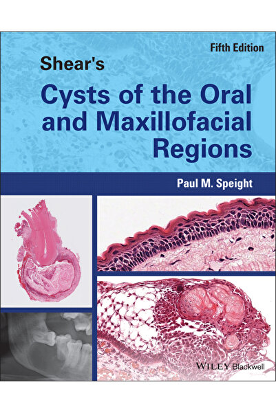 Wiley-Blackwell Shear's Cysts of the Oral and Maxillofacial Regions