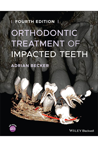 Wiley-Blackwell Orthodontic Treatment of Impacted Teeth