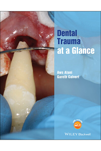 Wiley-Blackwell Traumă dentară: O privire rapidă