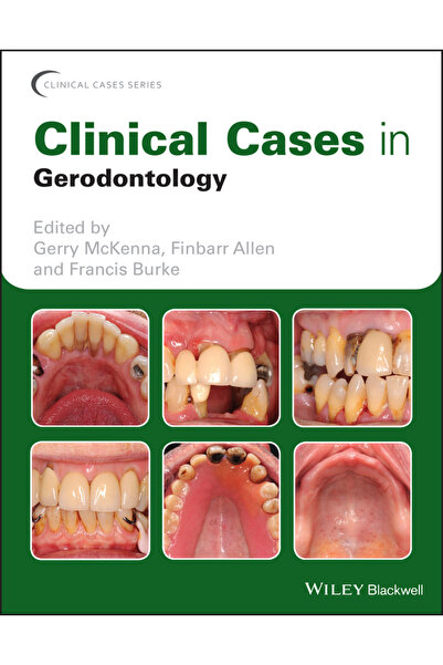 Wiley-Blackwell Cazuri clinice în gerodontologie
