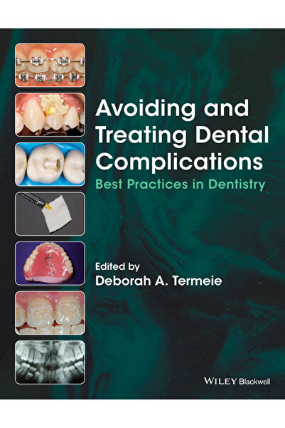 Wiley-Blackwell Prevenirea și Tratarea Complicațiilor Dentare: Practice de To...