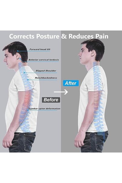 DMG TECH DMG Back Brace, Posture Corrector for Women and Men, Back Support Straightener, Upper Back Brace Pos
