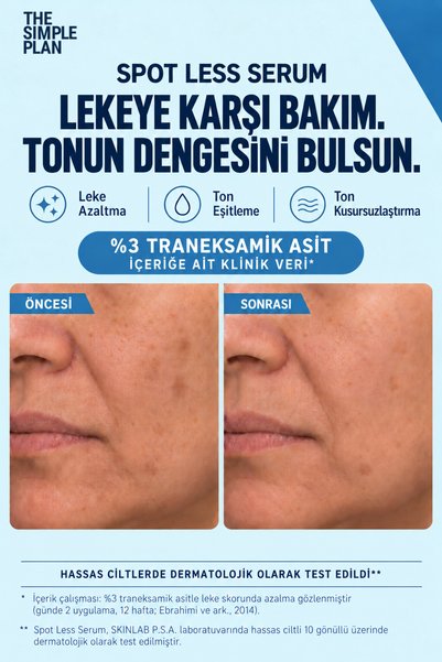 The Simple Plan Spot Less Serum – Leke ve Ton Eşitsizliği İçin Tranexamic Acid + Alpha-Arbutin + Niacinamide Serum 30 ml