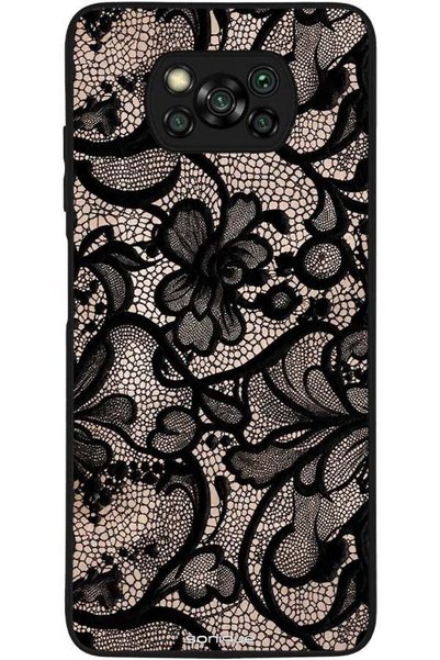 Sonique Θήκη Σειράς Diva για Xiaomi Poco X3 Nfc / Poco X3 Pro Μαύρη Δαντέλα