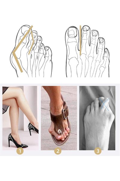 TERRIFI Gel Toe Separators for Kids, 2 Pair Bunion Corrector Pads with 2 Loop...