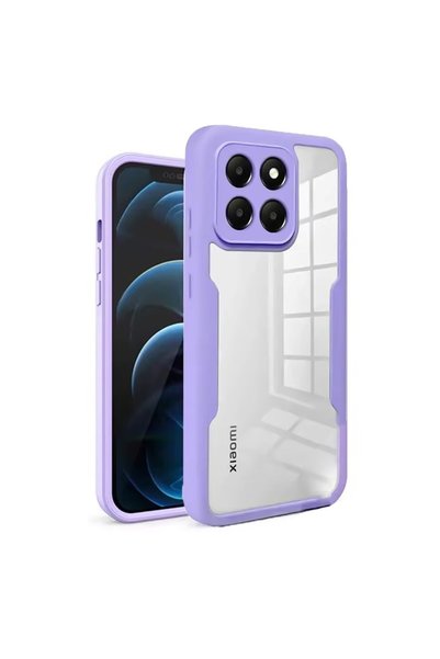 FONIX 360-degree case compatible with Xiaomi 14, With included screen protect...