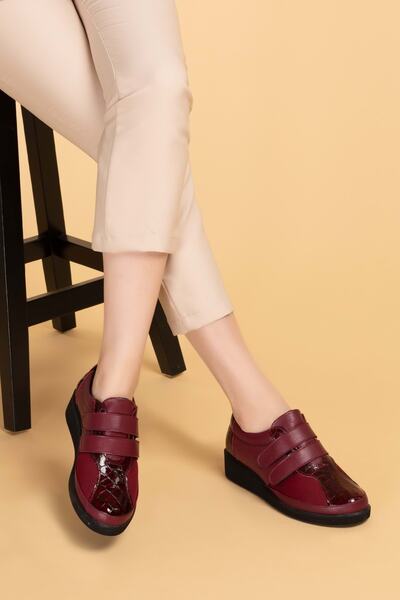 Gondol Hakiki Deri Kadın Kemik Çıkıntısına Özel Ayakkabı Bordo Vdt.1670