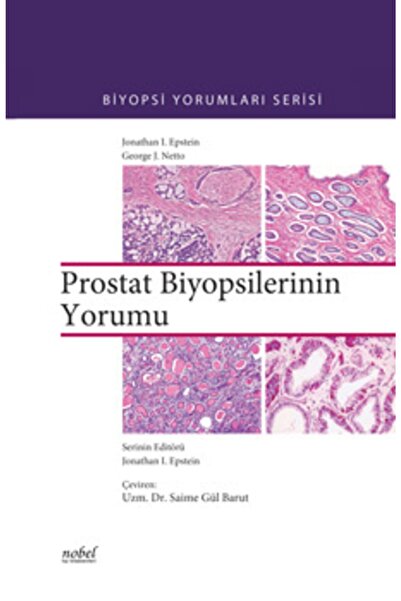 Nobel Tıp Kitabevi Prostat Biyopsilerinin Yorumu - Biyopsi Yorumları Serisi