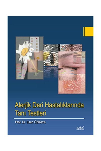 Dünya Tıp Kitabevi Alerjik Deri Hastalıklarında Tanı Testleri