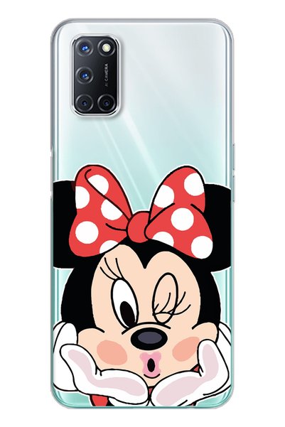 Spoyi Minne Designed Super Transparent Silicone Phone Case Oppo A52-A72